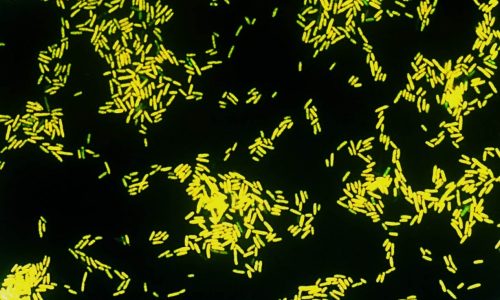 FISH-Analyse von Mikroorganismen - Custom FISH