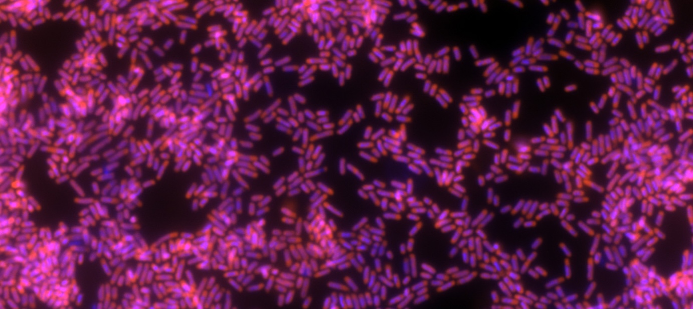 FISH microscopy background